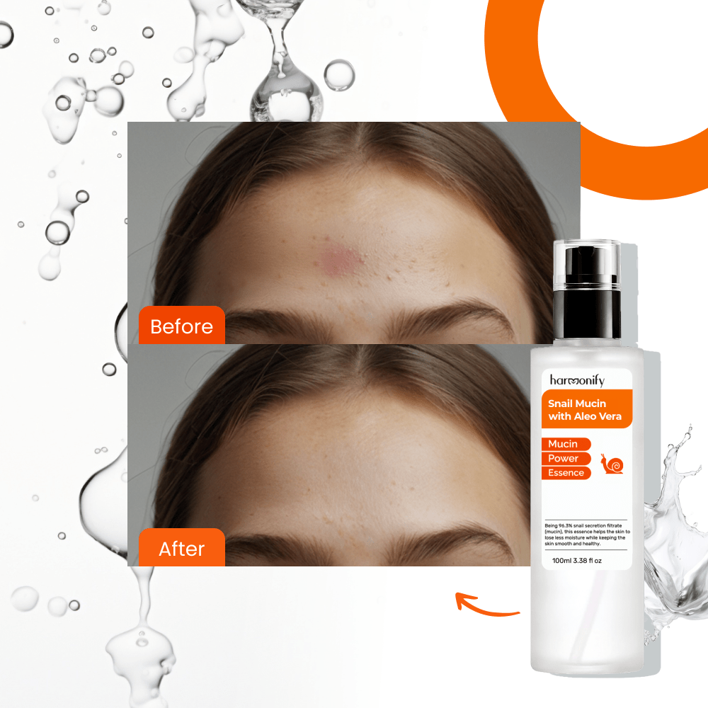 HARMONIFY Snail Mucin Serum, 96,3% Power Repairing Essence 3.38 fl.oz - HARMONIFY - HARMONIFY Snail Mucin Serum, 96,3% Power Repairing Essence 3.38 fl.oz - HARMONIFY - HARMONIFY Snail Mucin Serum, 96,3% Power Repairing Essence 3.38 fl.oz - 069 - HRF - SnailMucin - HARMONIFY - Beauty - 850056258180 - 069 - HRF - SnailMucin - HARMONIFY - Beauty - 850056258180